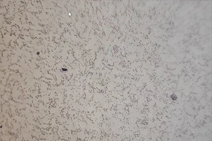 Metallografische Prüfung – 500-fache Vergrößerung